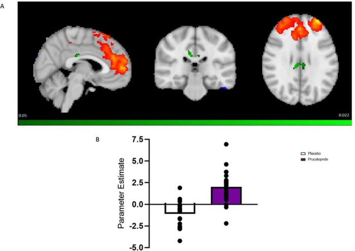 This figure shows that the healthy participants who received prucalopride had greater functional connectivity between key cognitive regions (the posterior / anterior cingulate cortices) and a major cognitive network (the central executive network). That is, they appeared to be strengthening their connectivity within cognitive networks.
