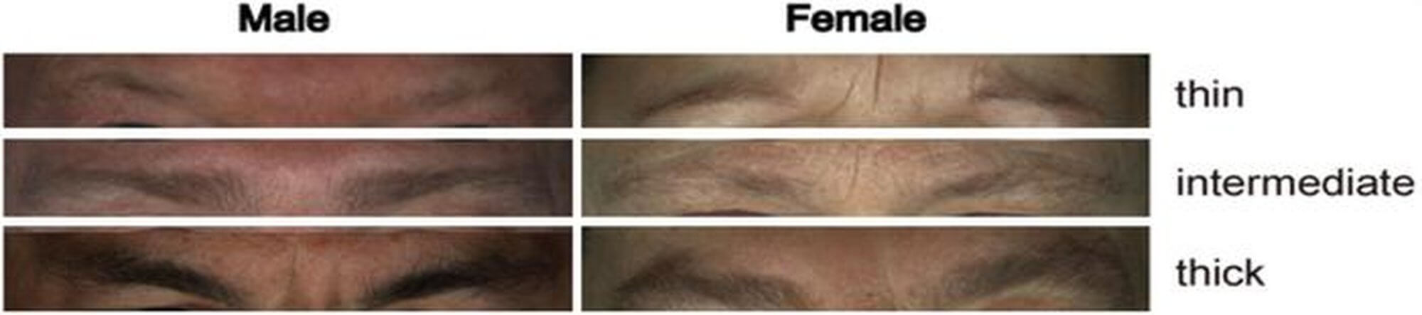 Example images illustrating eyebrow thickness classified into three categories, i.e., 0-thin, 1-intermediate, and 2-thick.