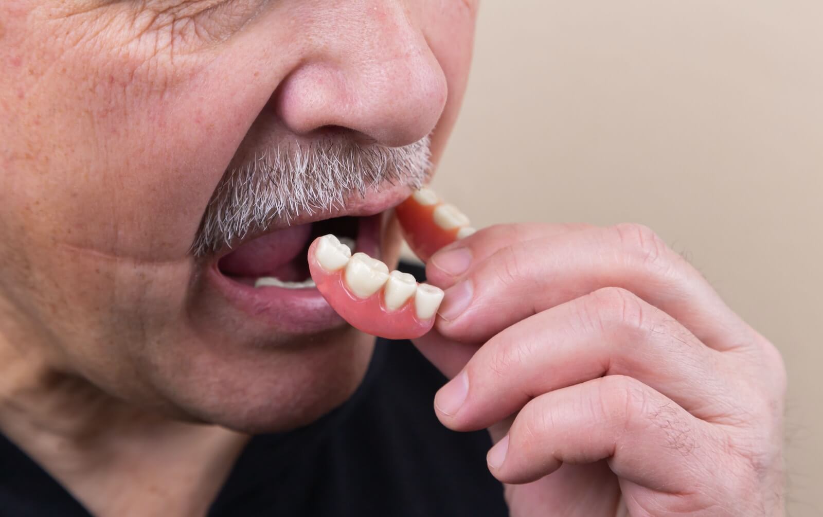 man removing dentures