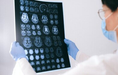 Picture of a doctor holding an MRI image of the brain.