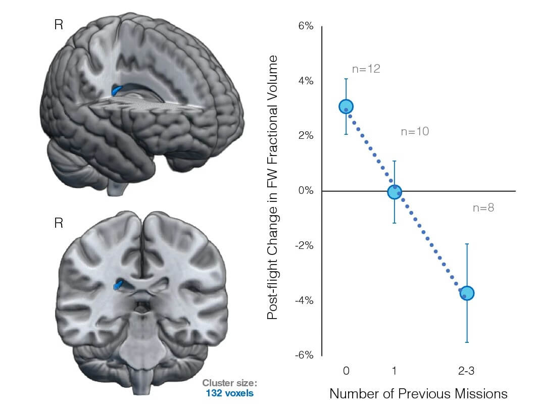 graphic of a gray brain in from the front and the side with two small blue dots in the center, right side of graphic shows changes indicated by long blue line on a graph