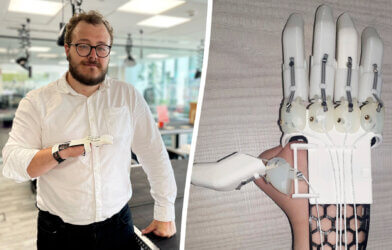 Luke Cox and his prosthetic hand