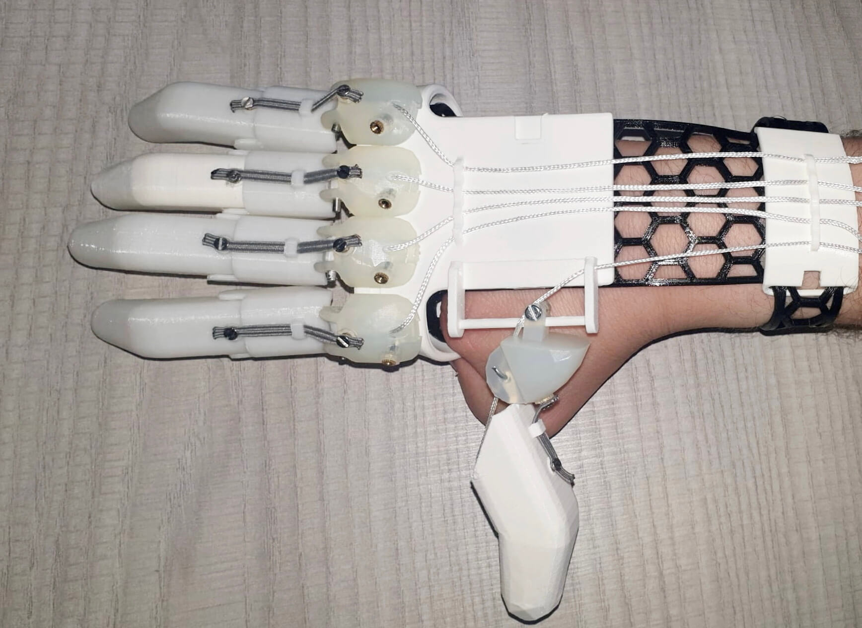 Luke Cox's prosthetic hand prototype.