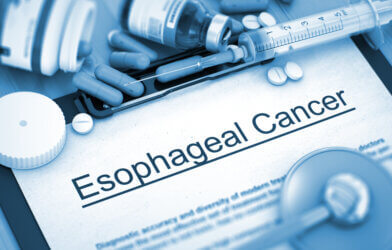 Esophageal Cancer Diagnosis