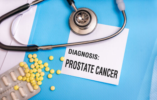Prostate cancer pills