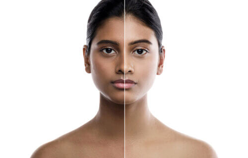 Indian woman and result of skin whitening treatment