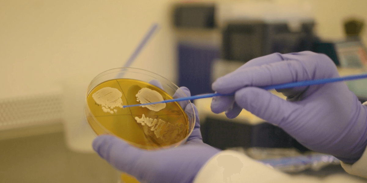 A researcher selects a colony of yeast from an agar plate.