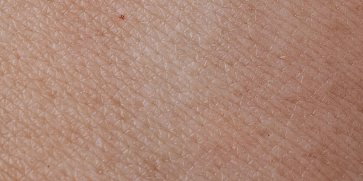 Skin exposed to too much sun can turn "leathery," but little research has been done to determine why that happens