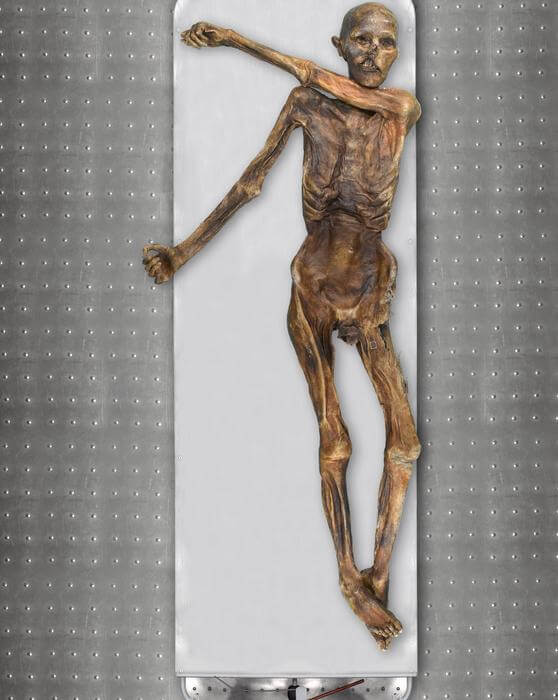 Body of a Tyrolean Iceman
