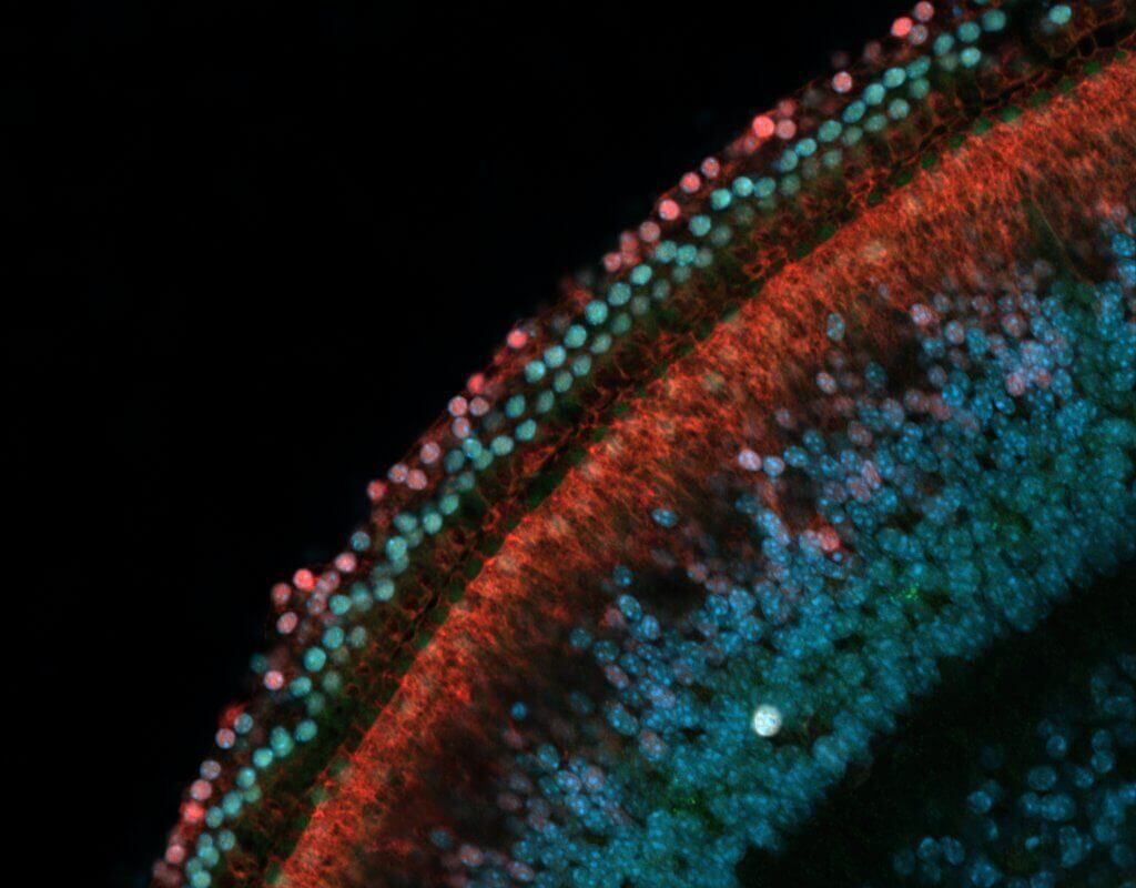 Rows of sensory hearing cells (green) next to supporting cells (red) in the inner ear of a mouse