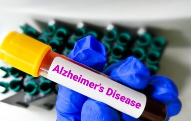 Alzheimer's Disease Blood Test