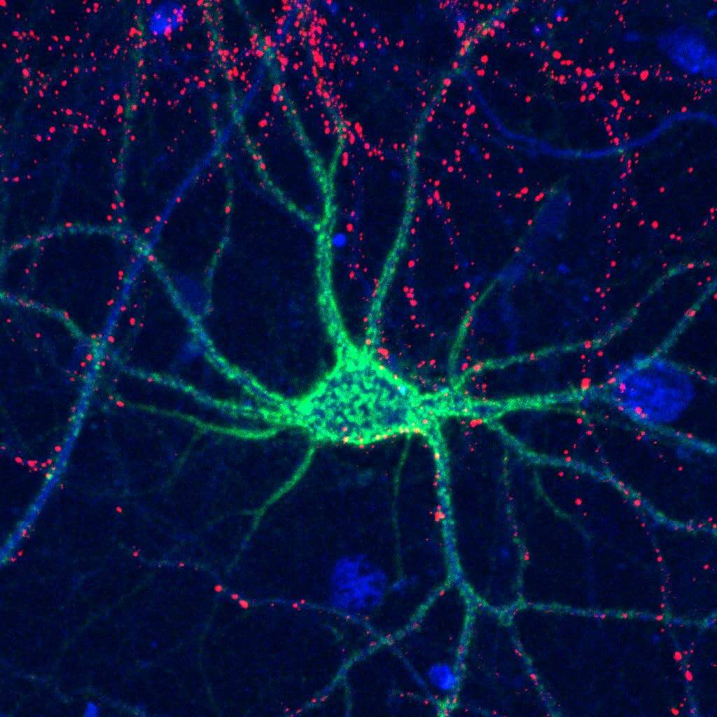 Complex sugar molecules control the formation of perineuronal nets (shown here in green) that surround neurons to help stabilize connections in the brain