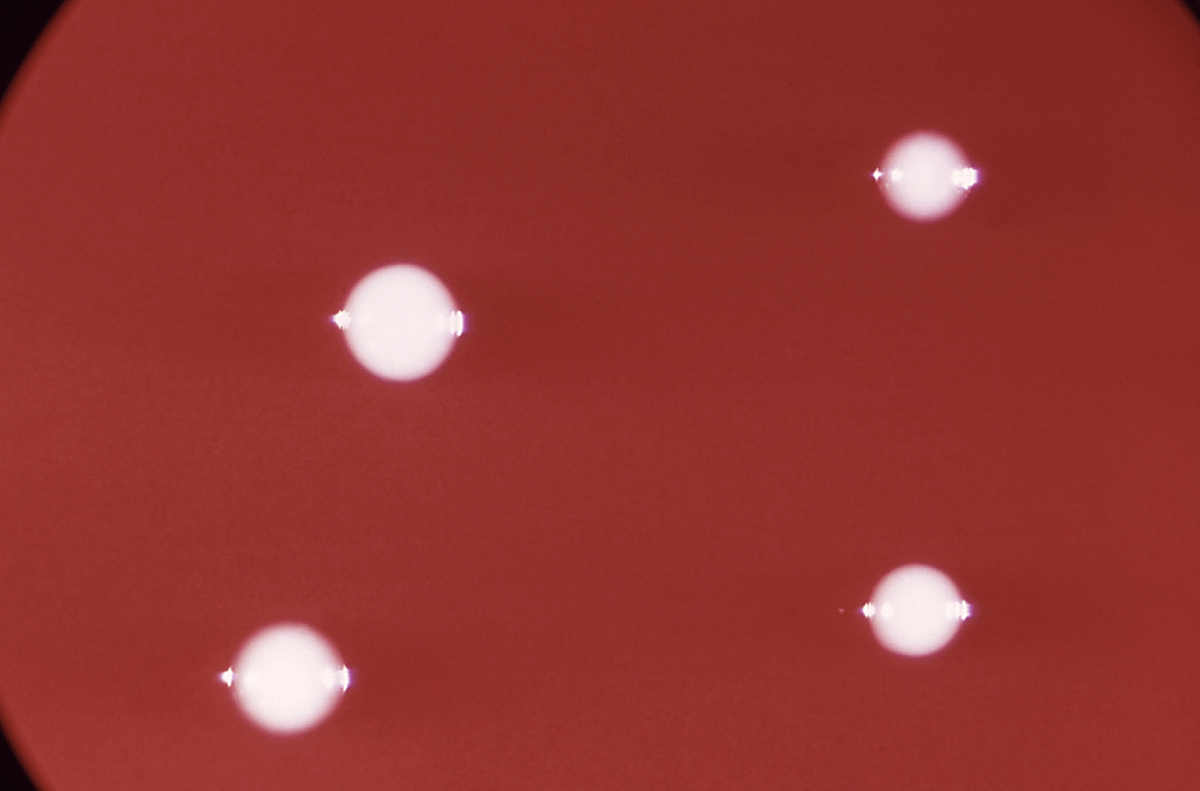 Propionibacterium acnes bacteria growing in a petri dish.