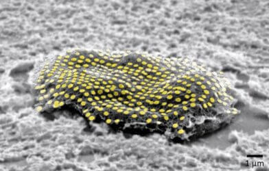 False-colored gold nanodot array on a fibroblast cell