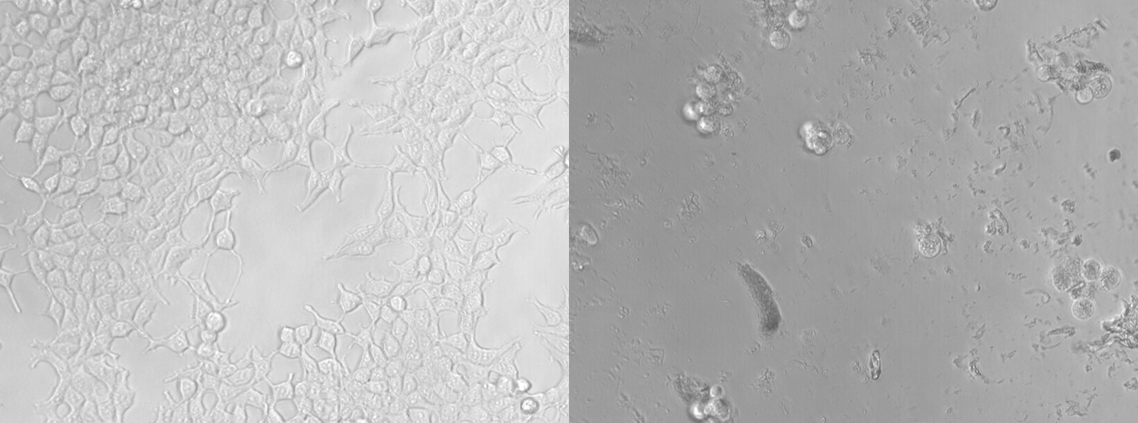 A side-by-side comparison of embryonic kidney cells left untreated (left) versus those treated with micro- and nanoplastics (right) for 72 hours. 