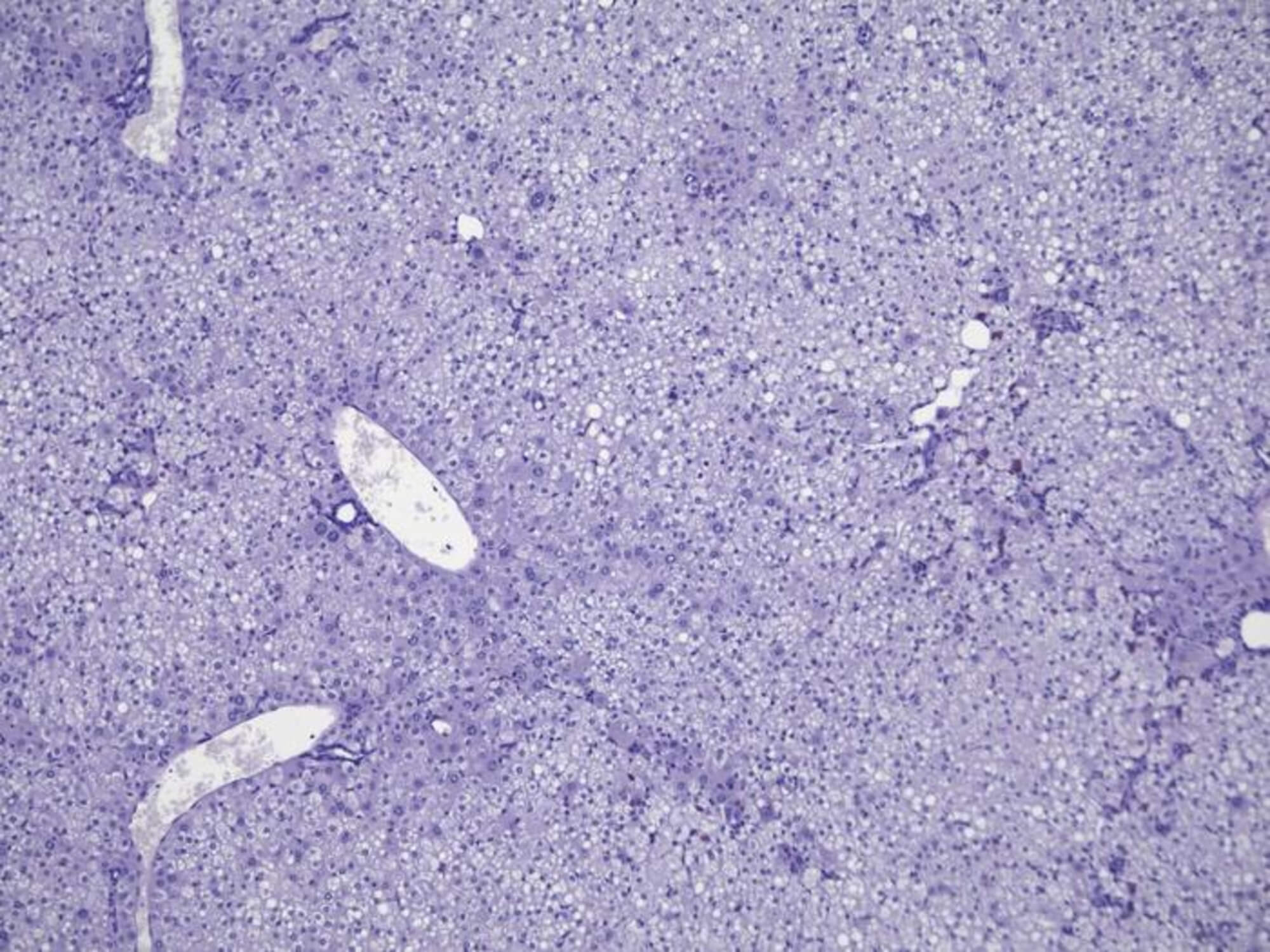 Healthy human liver cells (shown in purple) in a humanized mouse model