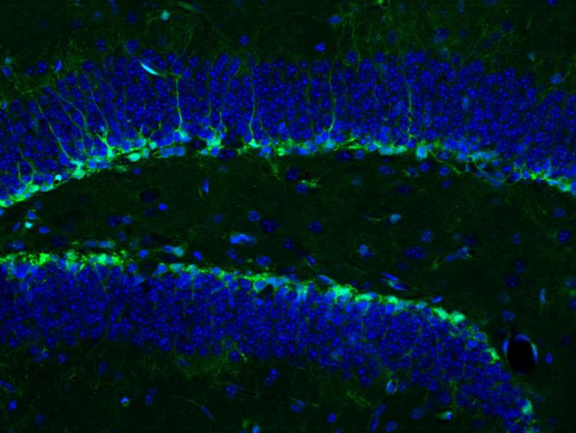 Neural stem cells in a mouse hippocampus shown in green (cell bodies shown in blue) give rise to new mature neurons