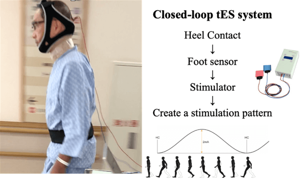 Patient with Parkinsonian gait disturbances seeking brain stimulation to improve walking dynamics