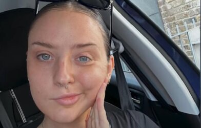 Woman sitting in a car taking a selfie to show paralysis in half of her face.