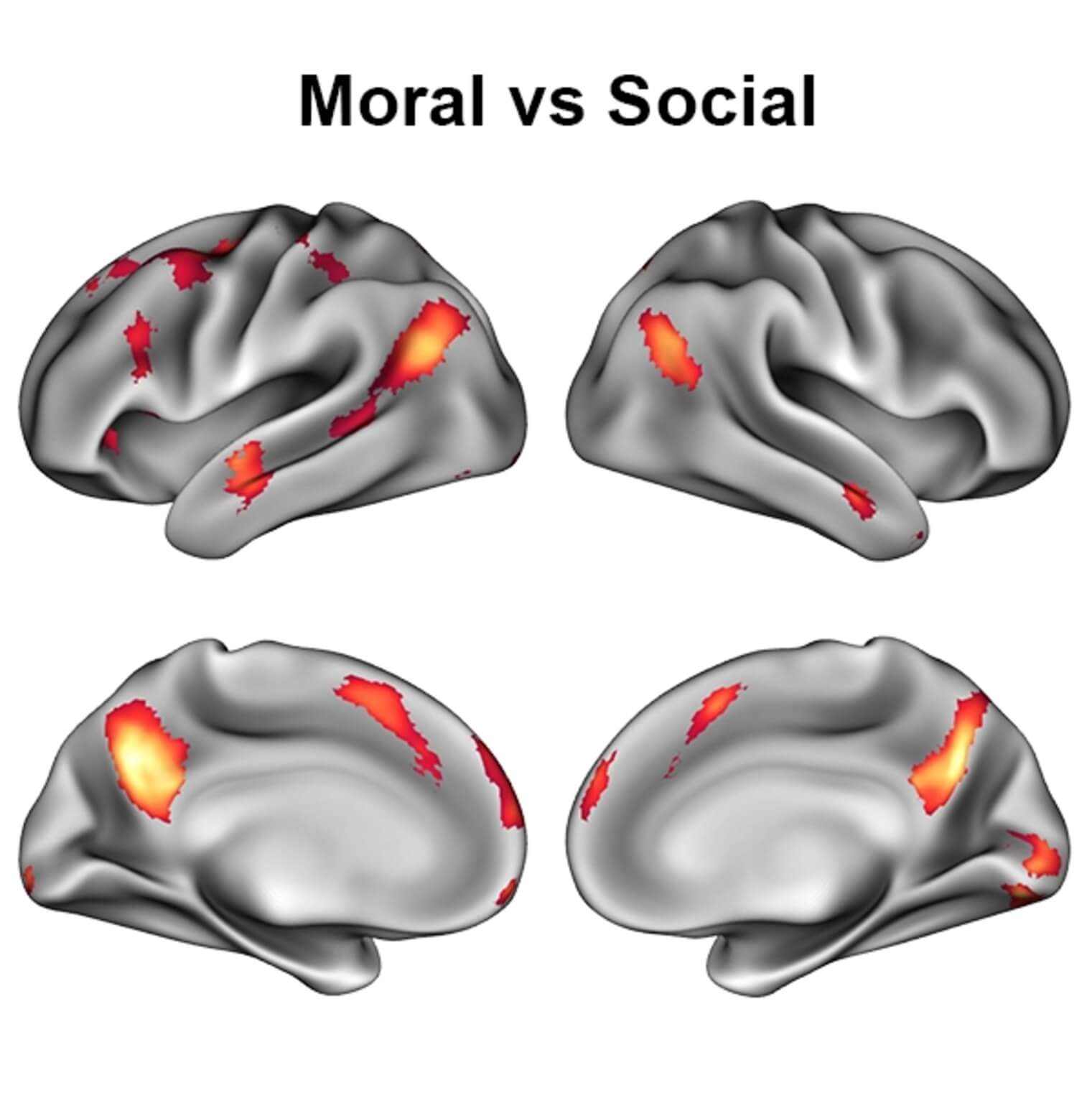 Making moral judgements activated different regions of the brain than merely evaluating social norms.