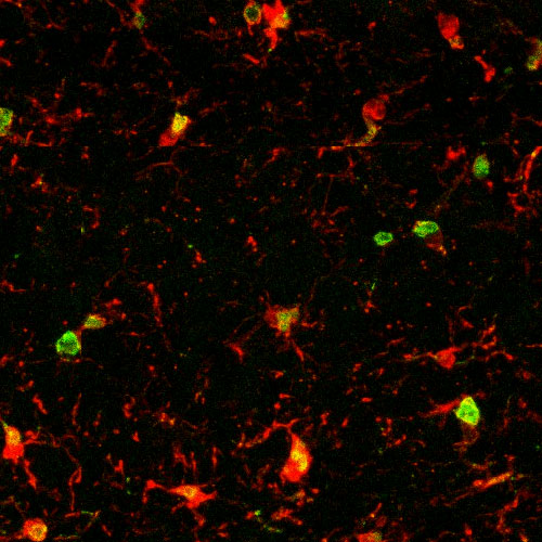 This microscopic image shows microglia, immune cells in the brain, in red. The green and yellow areas point to age-related inflammation in an old mouse.