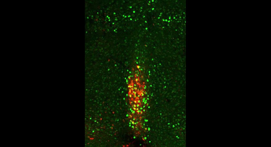 Neurons in the Xiphoid nucleus are activated by cold (green)