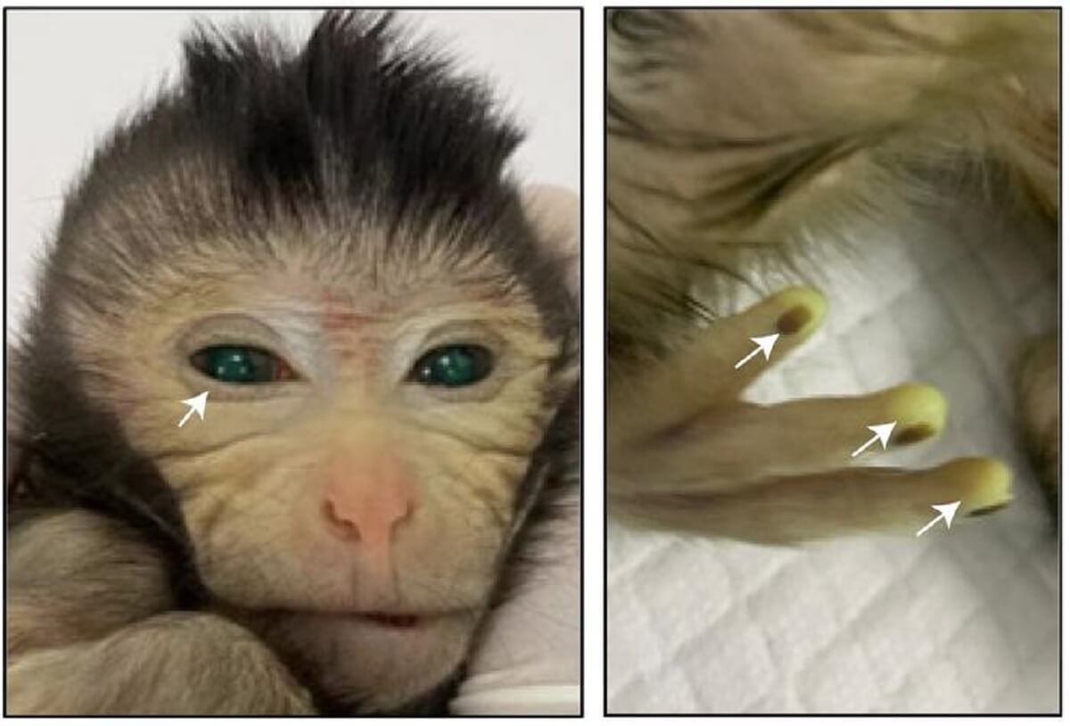 Images showing the green fluorescence signals in different body parts of the live-birth chimeric monkey at the age of 3 days. (CREDIT: Cell/Cao et al.)