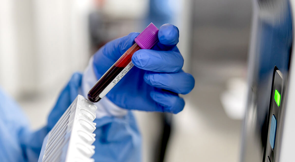 Close-up on a technician analyzing blood samples at the lab and holding a test tube