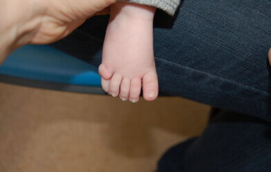 The foot of one of the children in the study, showing an extra toe