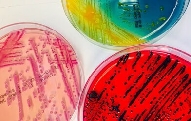 bacteria samples