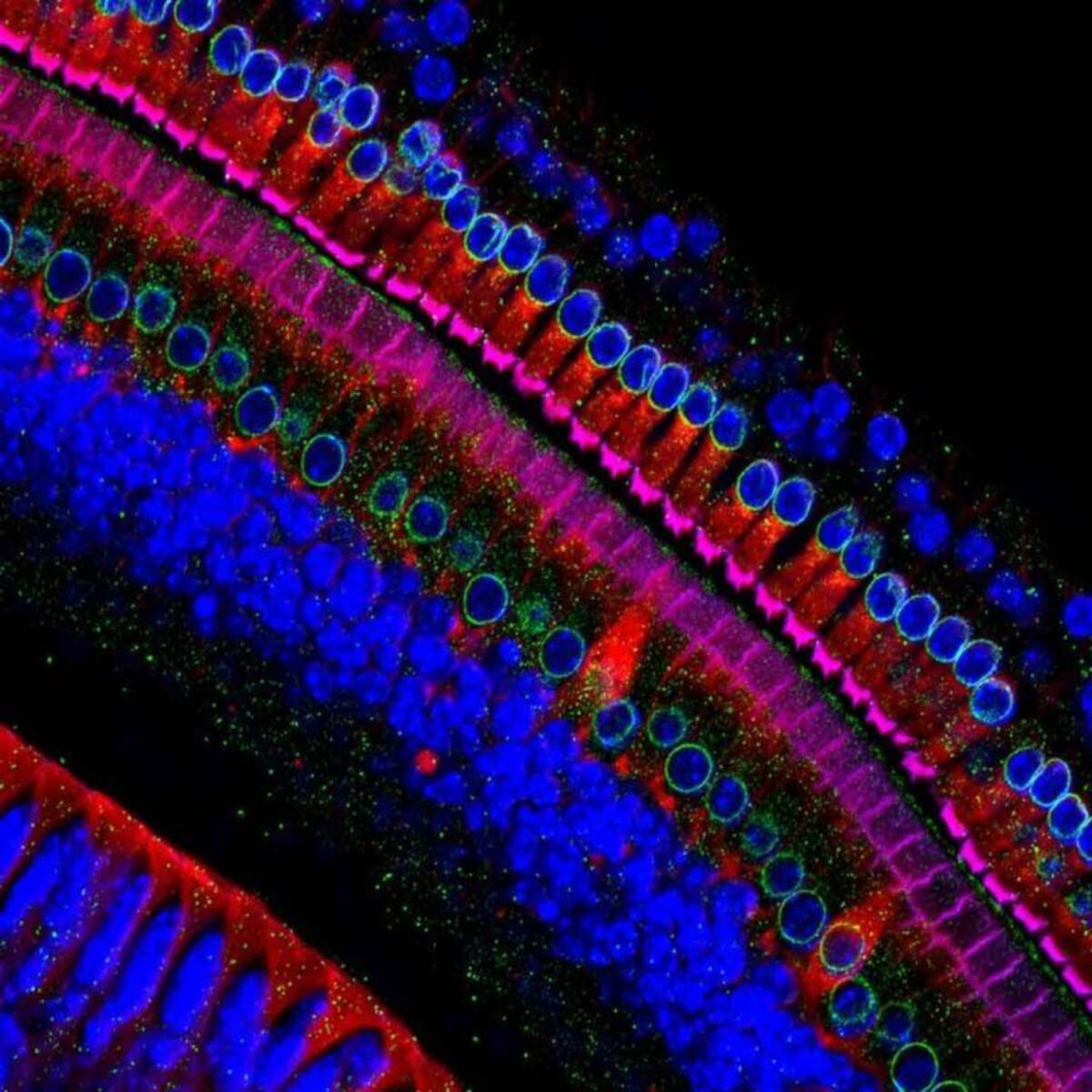 Hair cells are the sensory cells of the ear, named for their hair-like structures that bend in response to sound