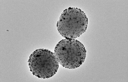Transmission electron microscopy image of the nanorobots.