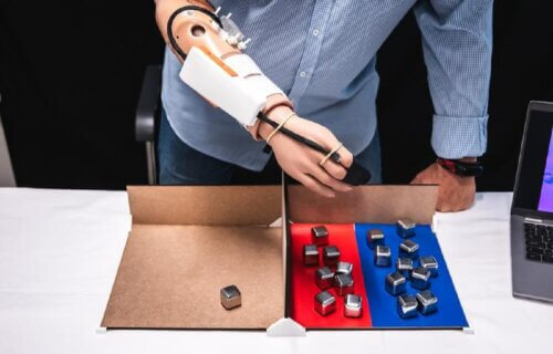A sensory-motor hand prosthesis with integrated thermal feedback.