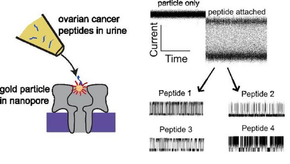 graphic: How gold nanoparticles help identify peptides in urine in patients with ovarian cancer. 