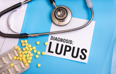 Lupus diagnosis written on medical folder