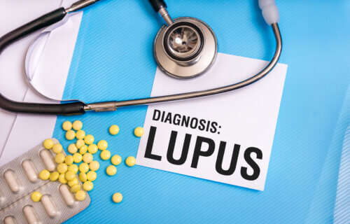 Lupus diagnosis written on medical folder
