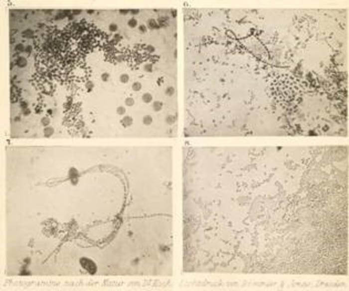 photographs of bacteria