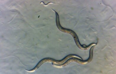 Worms collected in the Chornobyl Exclusion Zone, as seen under a microscope.