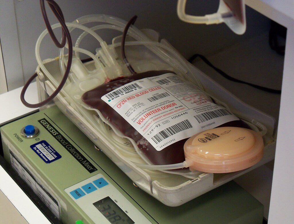Blood transfusion, which are usually life-saving procedures, can become life-threatening if they trigger an allergic reaction
