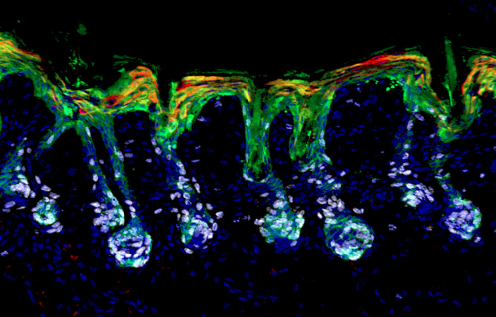 Hair follicle stem cells (green) mobilize and expand (white) to help repair the skin’s barrier by differentiating into epidermal lineages (red).
