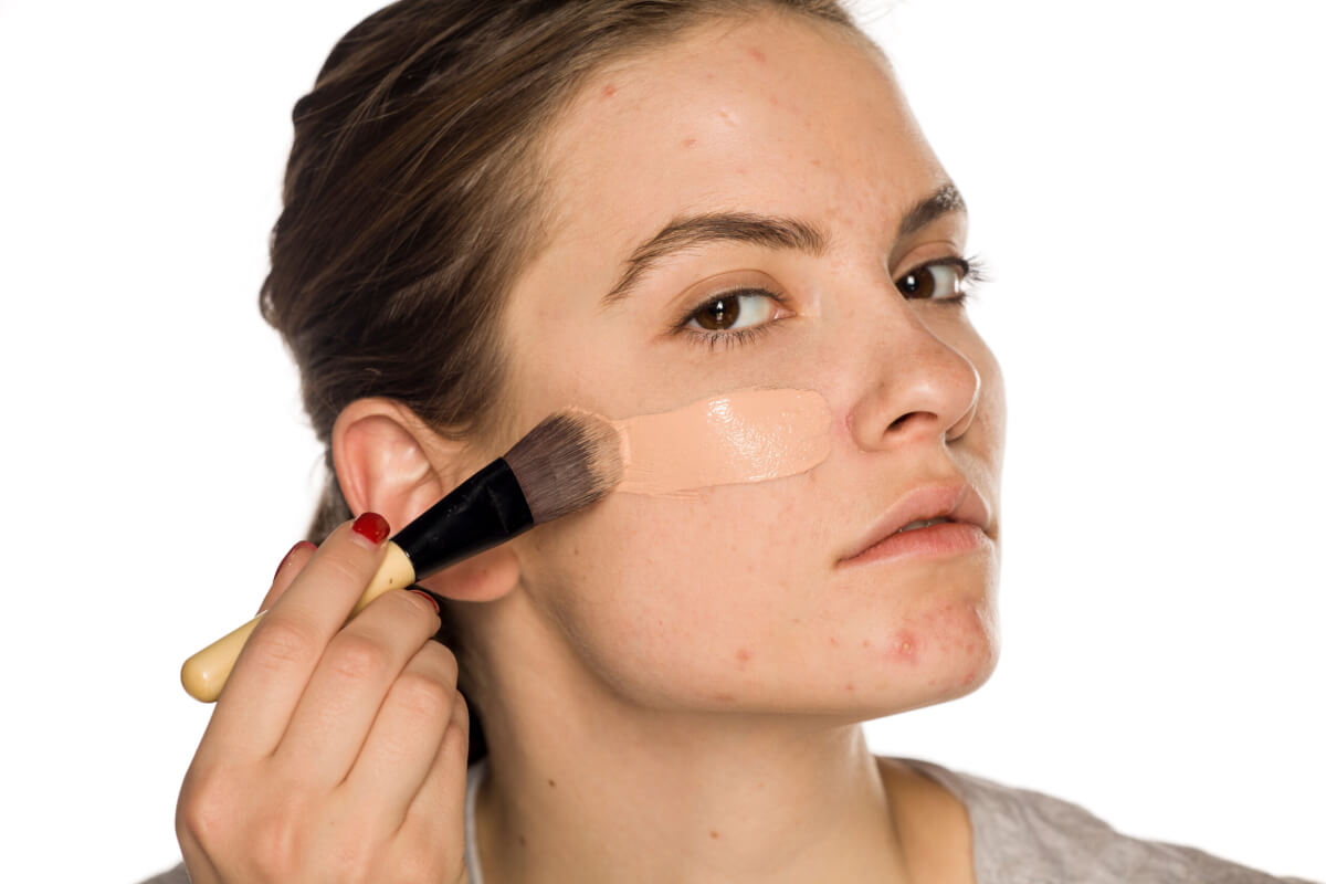 A woman with problematic skin applying foundation