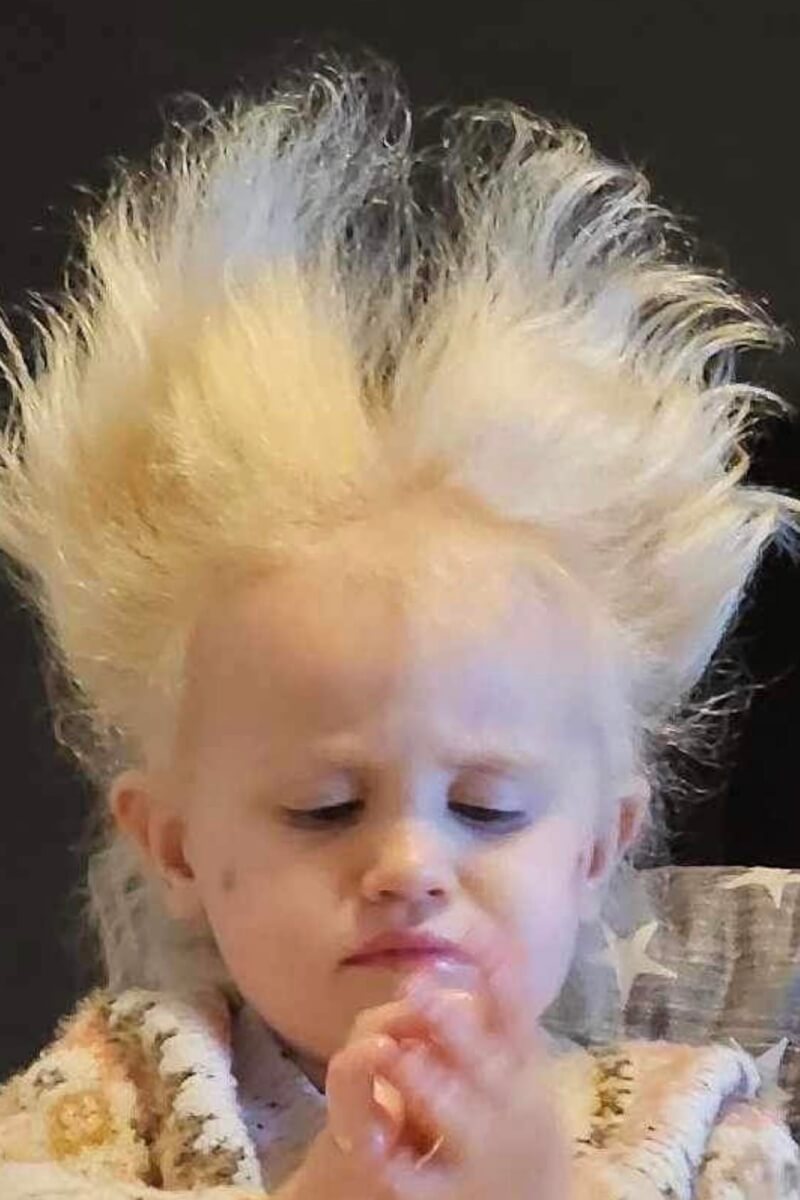 Nellie Butler, two, is believed to have uncombable Hair Syndrome 