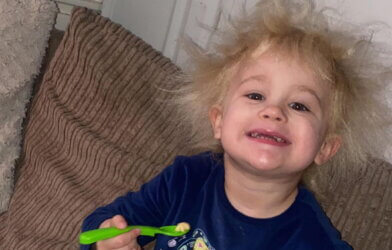 Nellie Butler, two, is believed to have uncombable Hair Syndrome