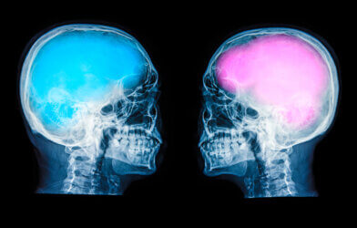 Image portraying gender brain differences: X-rays of two skulls, one with a pink brain and one with a blue brain