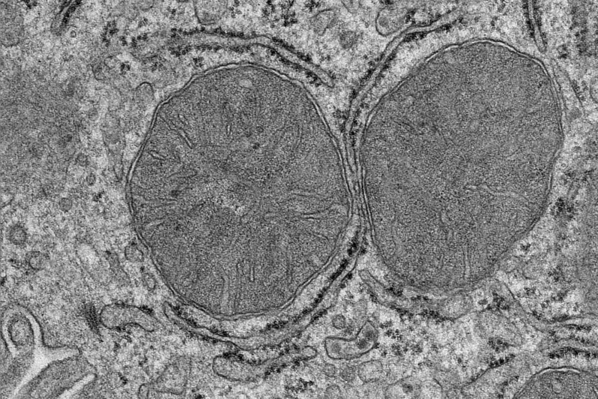 The mitochondria in the liver change their shape as soon as food is perceived. The image shows an electron micrograph of the mitochondria in liver cells. 
