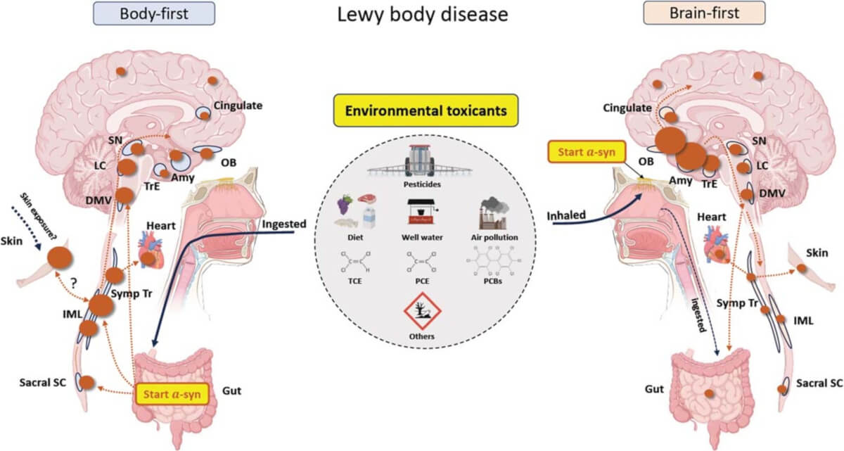 A proposal on how environmental exposure to toxicants may cause either body-first or brain-first Lewy body disease
