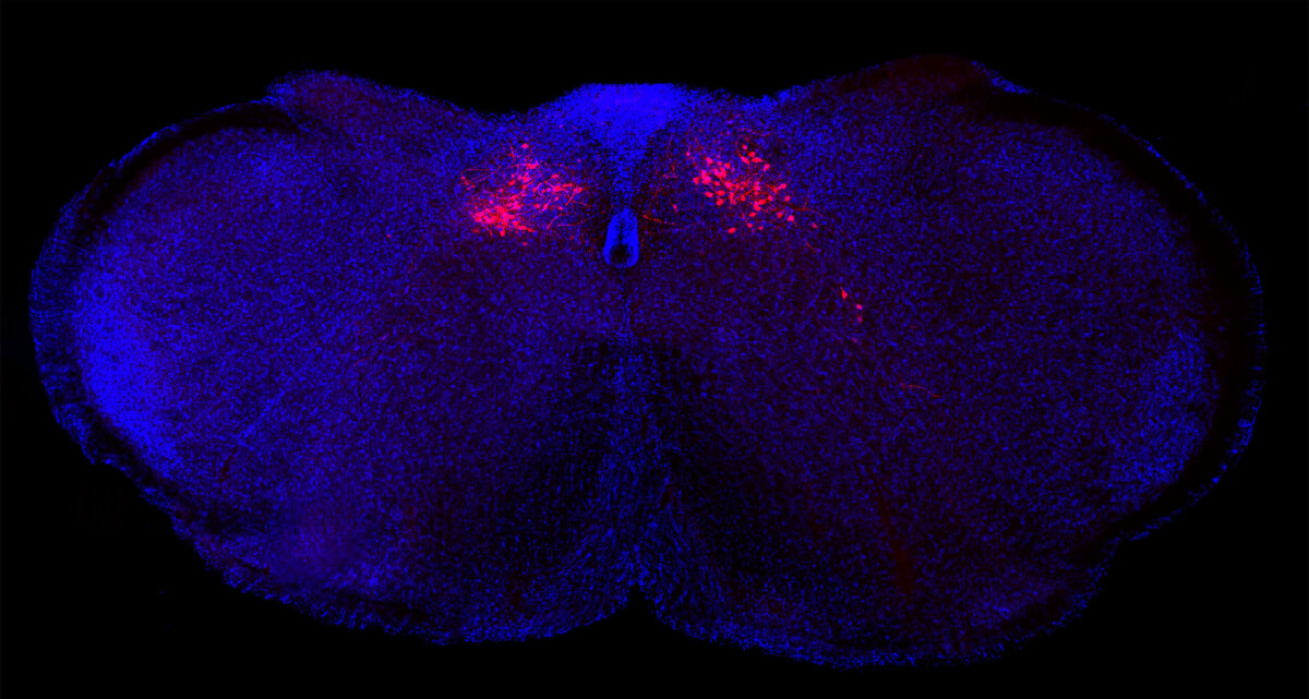 Labeled in red are neurons in the brainstem of a mouse that control body inflammatory responses