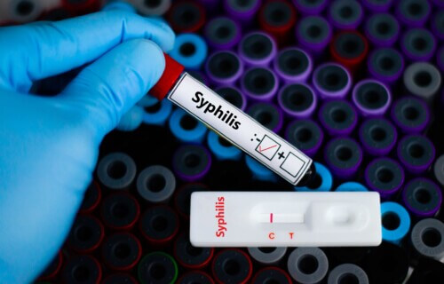 Blood sample of patient negative tested for syphilis by rapid diagnostic test.